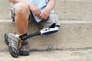 TPD and income protection claims for amputees