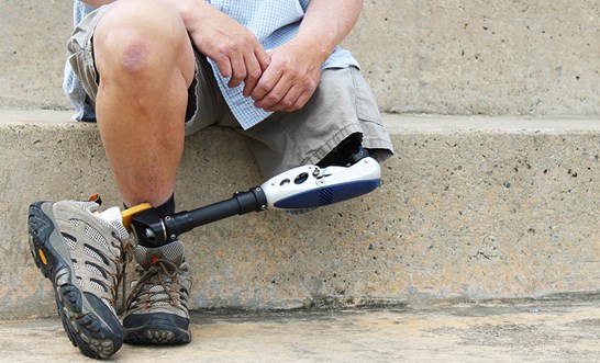 TPD and income protection claims for amputees